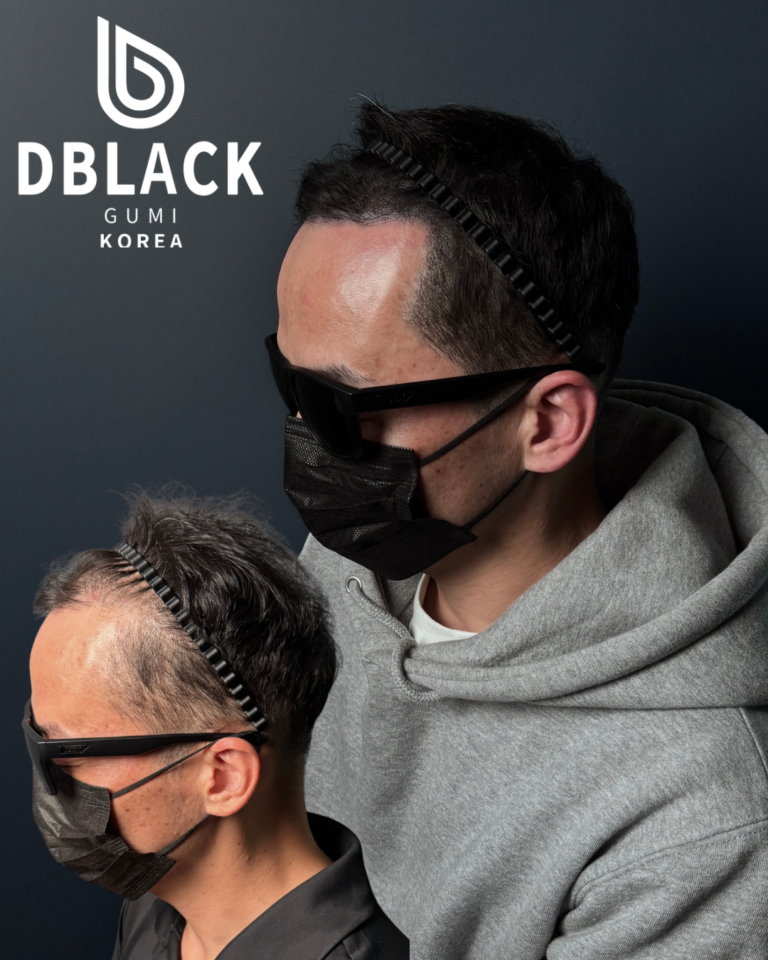 구미두피문신 남성 전체 숱채움