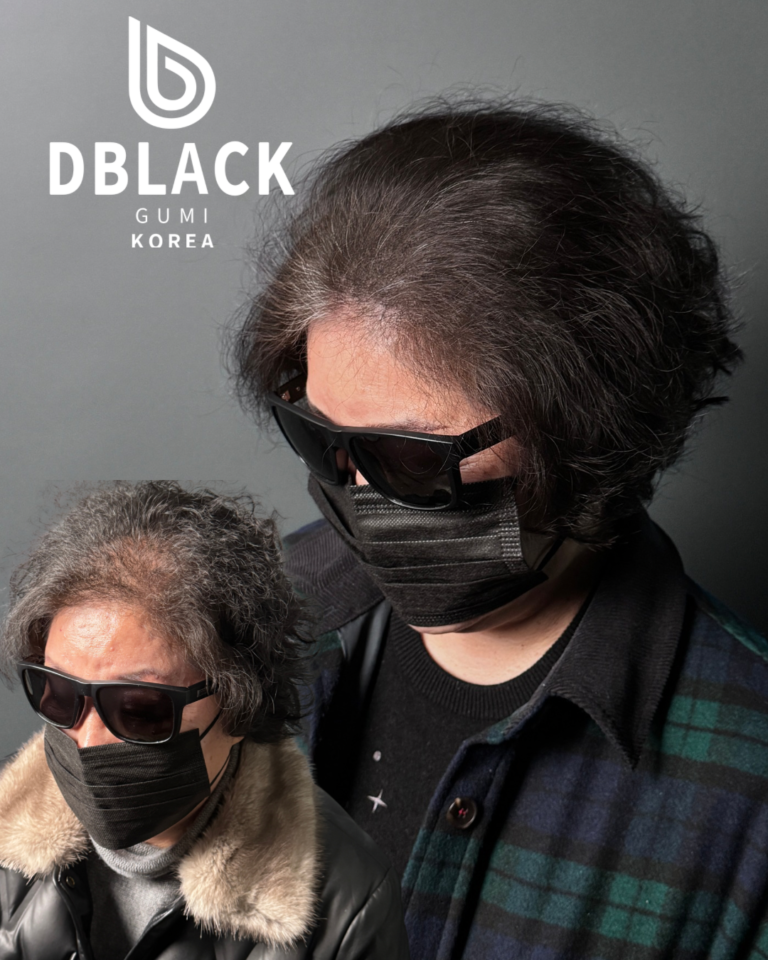 구미두피문신 여성전체숱채움